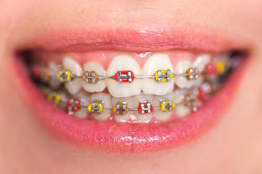 Orthodontic